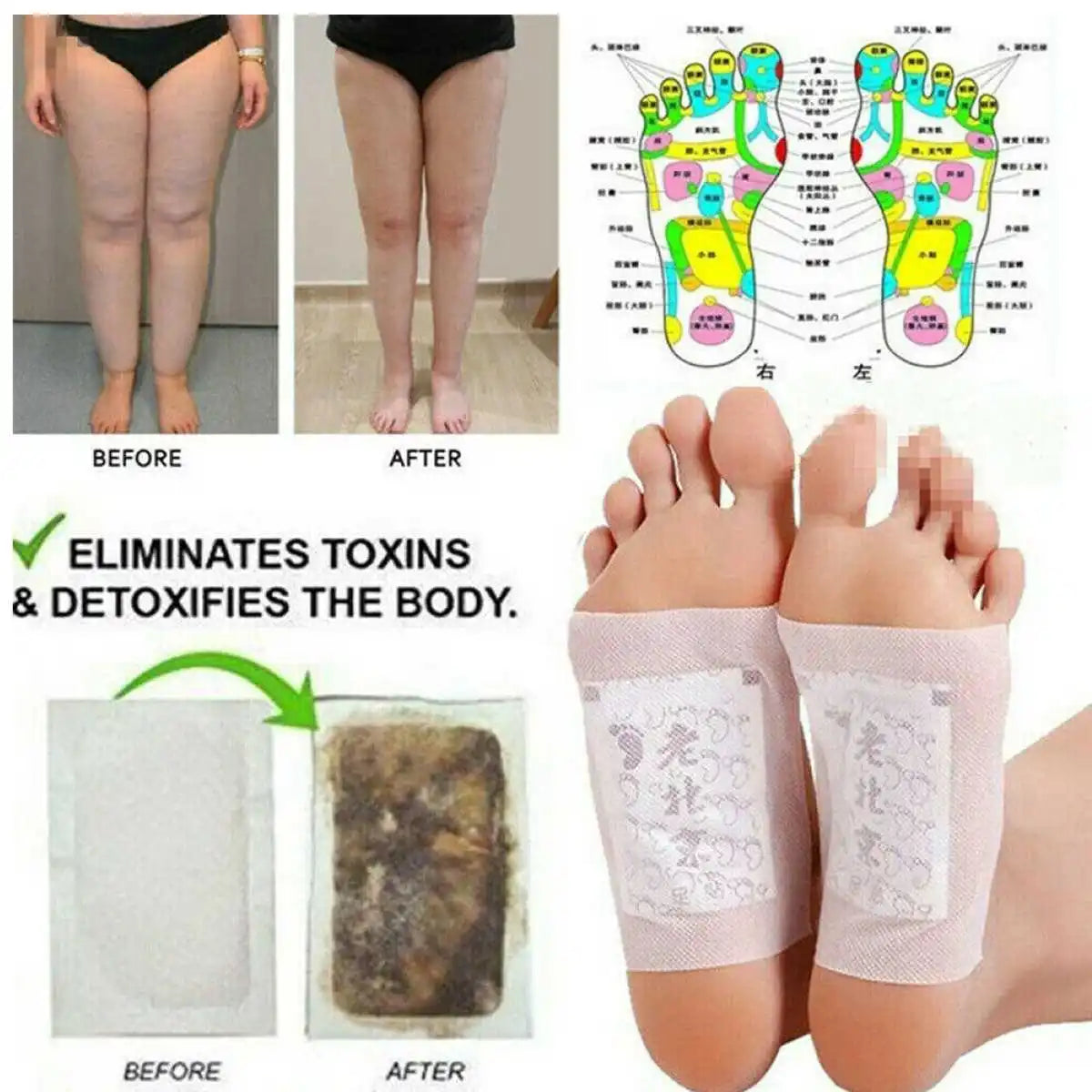 KINOKI DETOX FOOT PATCHES - Cleanse & Energize Your Body- 10 PCS/BOX