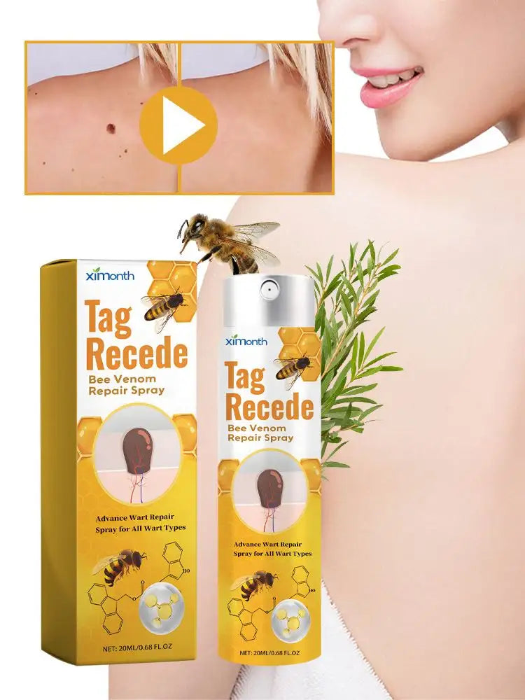 Tag & Wart Remover Spray - Wart and Tags Removal Treatment Spray
