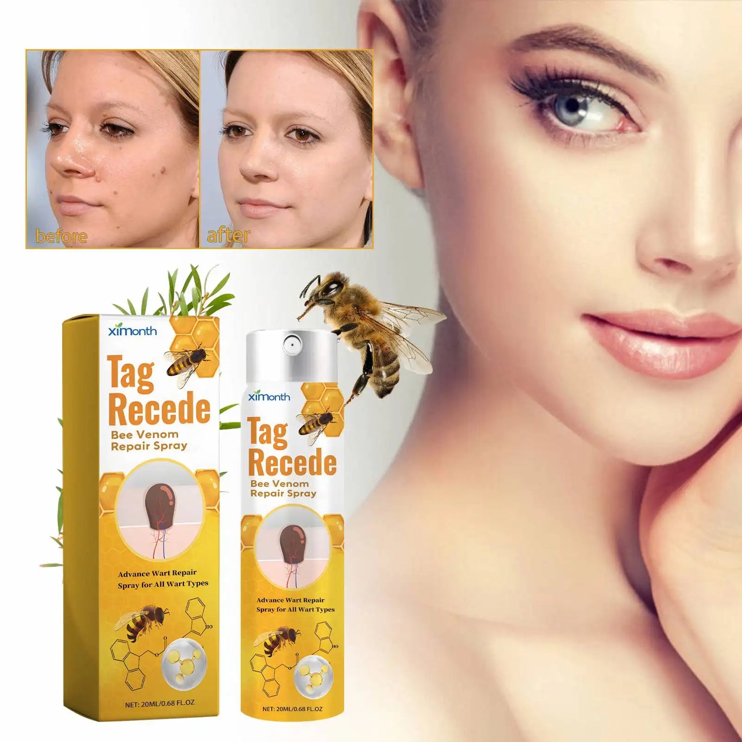 Tag & Wart Remover Spray - Wart and Tags Removal Treatment Spray