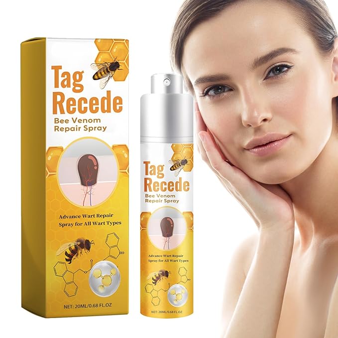 Tag & Wart Remover Spray - Wart and Tags Removal Treatment Spray