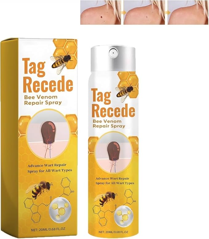 Tag & Wart Remover Spray - Wart and Tags Removal Treatment Spray