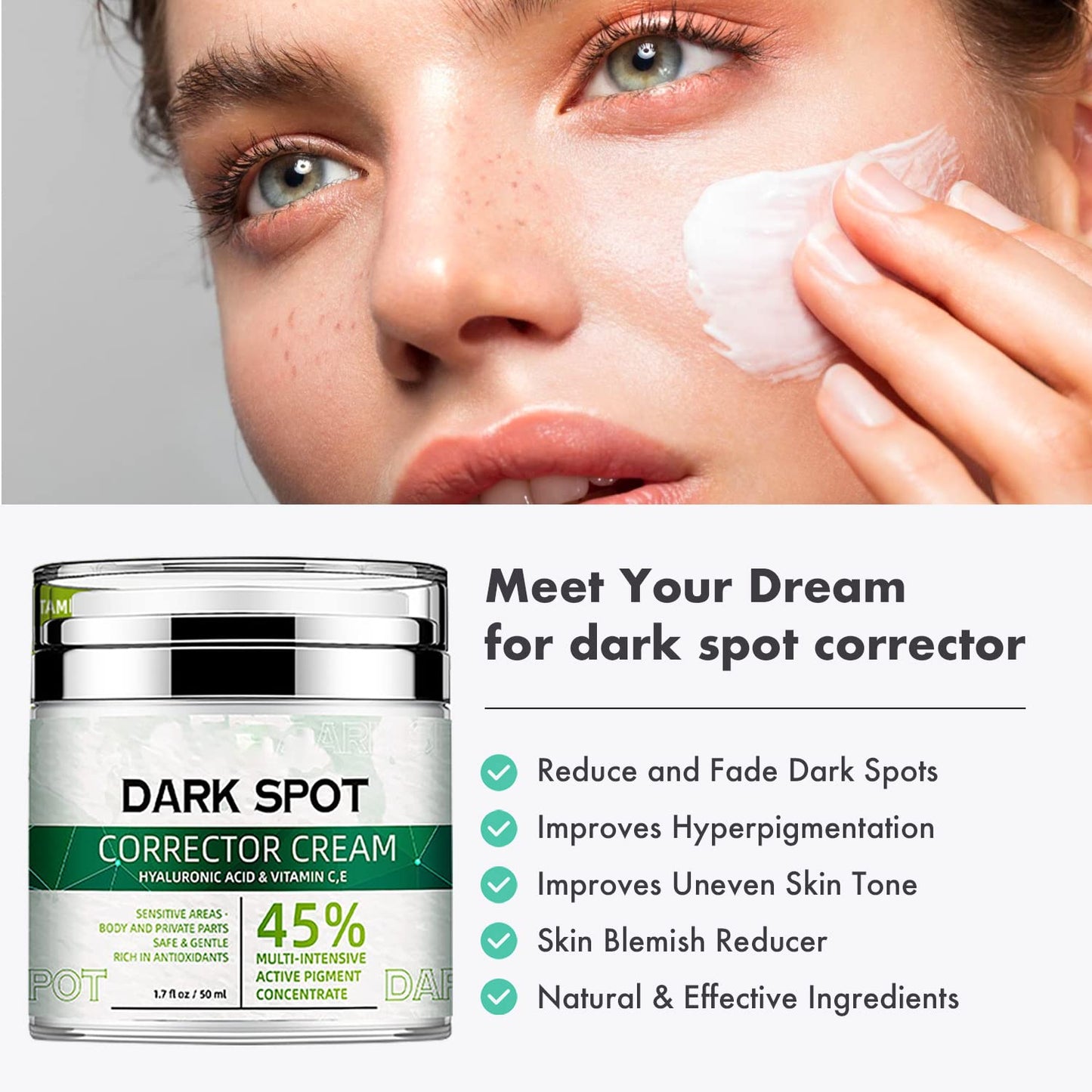 Dark Spot Remover Cream for Pimples, Sun Spot, Melasma, Freckle, Hyperpigmentation, Age spot Removal for Women and Men